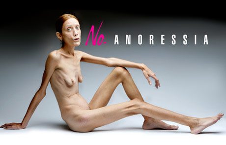 anorexia-campain